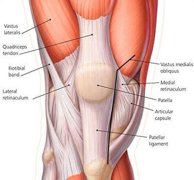 Medical illustration comparing the midvastus quad-sparing approach to the standard medial parapatellar approach for knee replacement